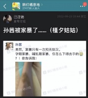 演员孙茜老公陷入舆论，曾被孙俪夸绝种好男人，如今却被爆料家暴