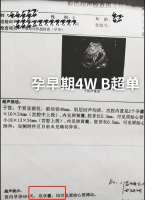 大衣哥新儿媳怀双胞胎！和老公牵手亲密接吻，给父母买豪华养老房