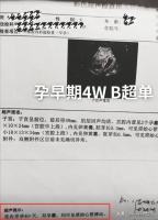 大衣哥儿子小伟终于开窍了，未过门媳妇晒出双胞胎检验单