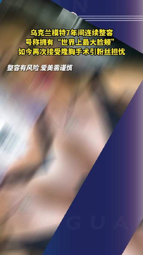 乌克兰模特7年间连续整容，号称拥有“世界上最大脸颊”……