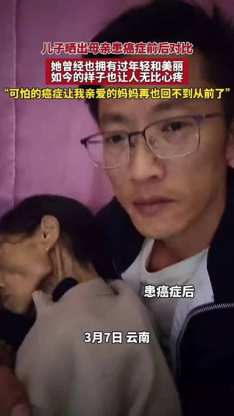 儿子晒出母亲患癌症前后对比，她曾经也拥有过年轻和美丽……