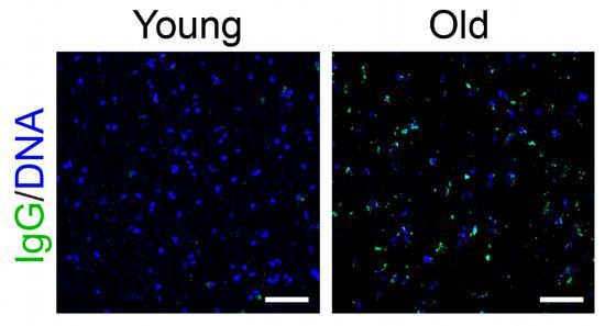 免疫球蛋白G在老年人的脑组织中积累。（中国科学院动物研究所供图）
