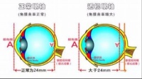 儿童青少年近视防控，“防”的到底是什么?